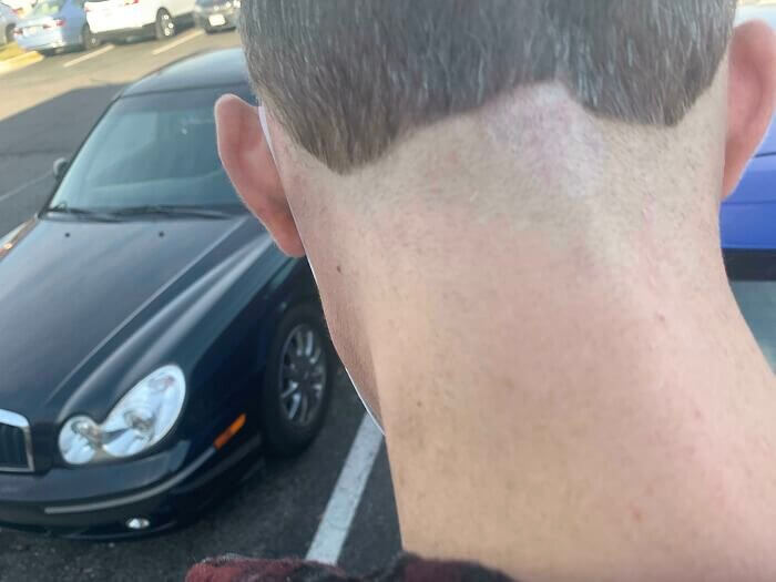 Is It Any Consolation to Remember That Hair Grows?