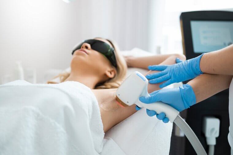 Laser Hair Removal in Sensitive Areas: Repeated "rubber Band" Snapping