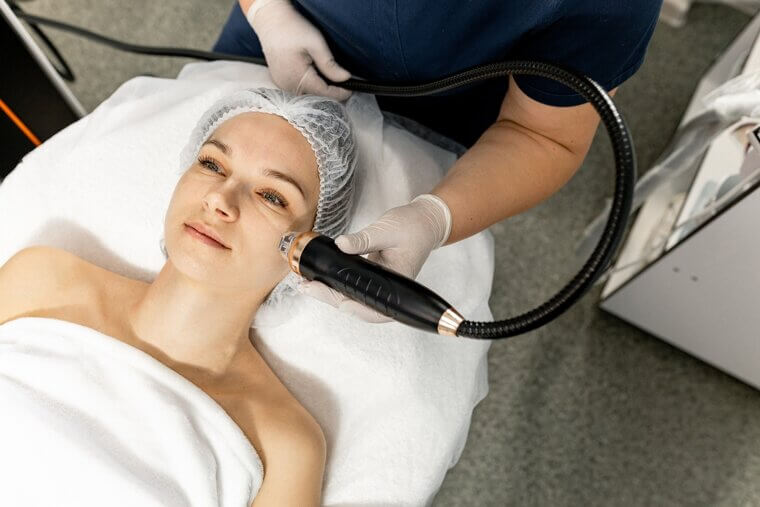 Microneedling With Radiofrequency: Heat and Needle Penetration