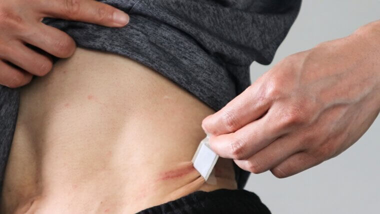Rib Removal for Waist Narrowing: Bone Trauma and Respiratory Restriction
