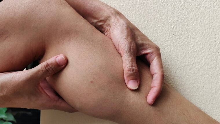 Liposuction of the Calves and Ankles: Gravity and Poor Circulation
