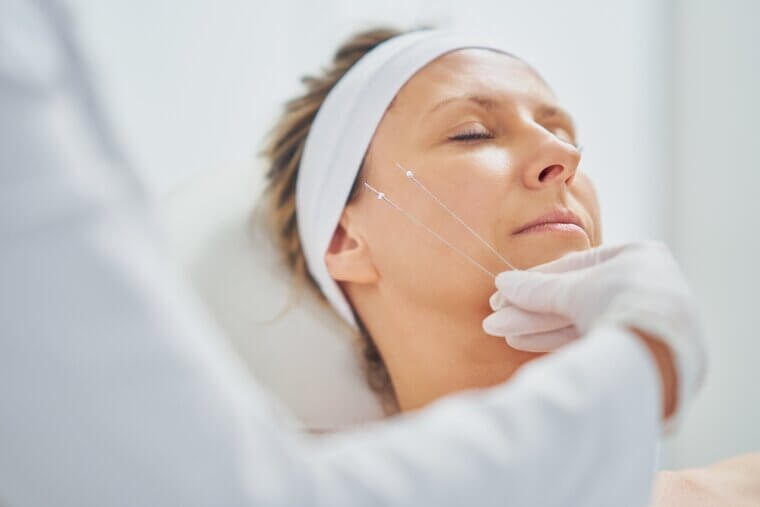 Thread Lift: Internal "tugging" and Sharp Needle Pokes