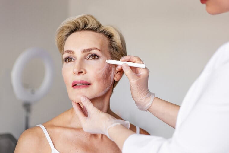 Deep Plane Facelift: Significant Swelling and Deep Tissue Manipulation