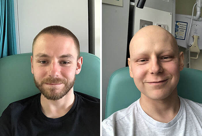 This Brave Guy Is Fighting Cancer With Three Months Of Hardcore Chemotherapy