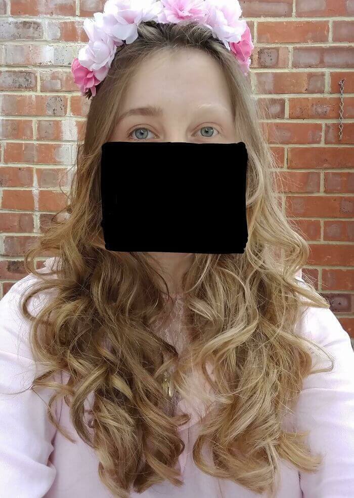 This Girl's Unusual Genetics Make Her So Unique And Beautiful