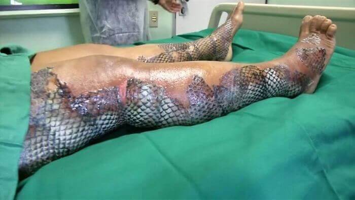 Are These Skin Grafts Real? They Seem Kind Of Fishy To Us