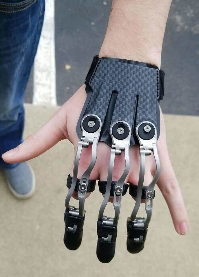 This Person's Cool Prosthetics Look Half Wolverine, Half Cyborg