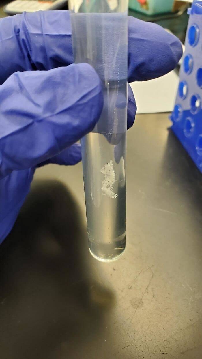 And That's What A Clump Of DNA Looks Like In Real Life