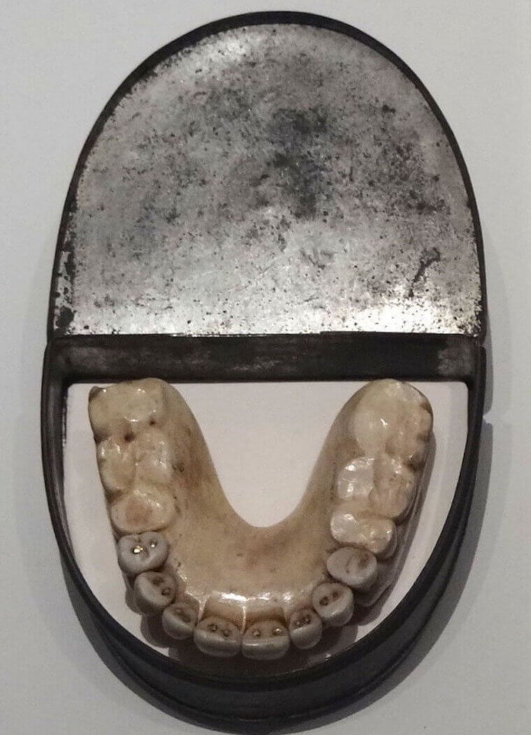 Making Dentures Out of Real Teeth
