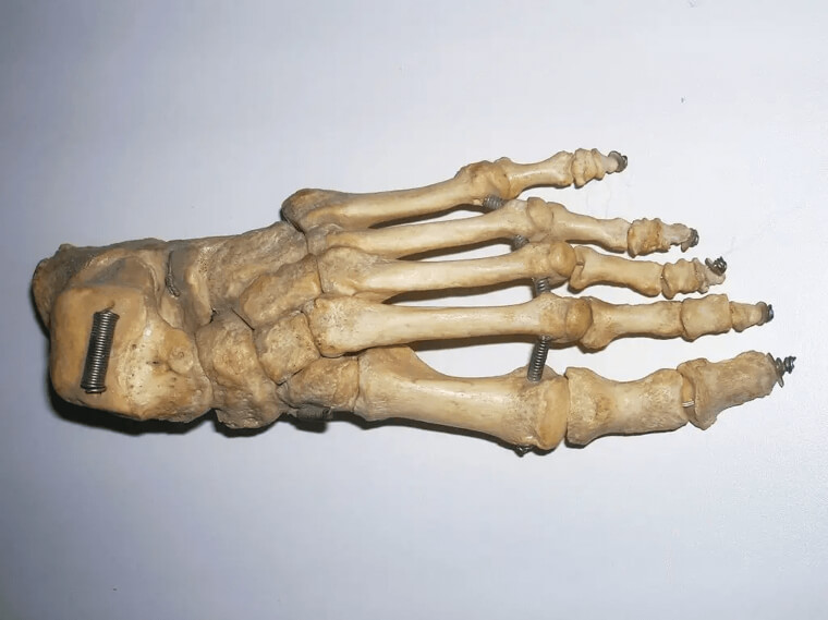12% Of Your Body’s Bones Are Located In Your Feet