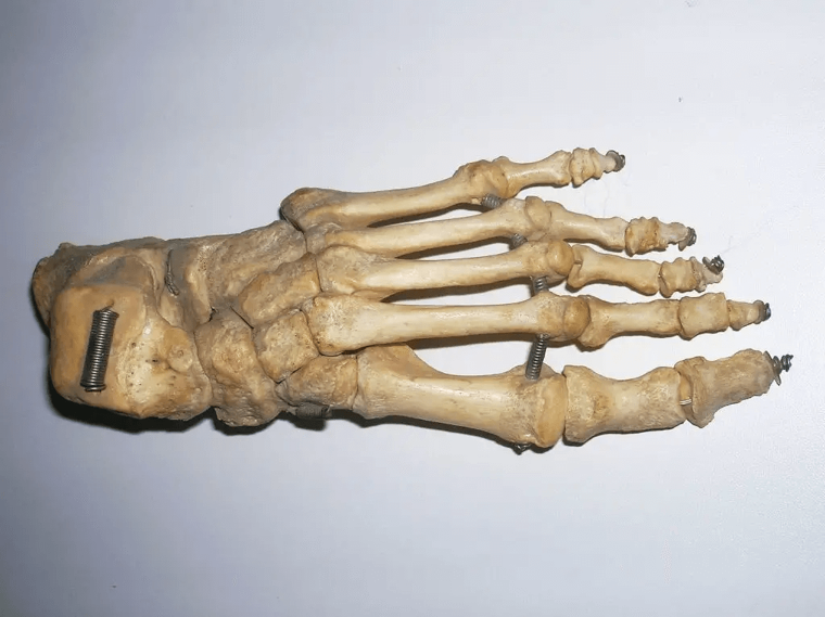 ​A Quarter Of Your Body’s Bones Are Located In Your Feet