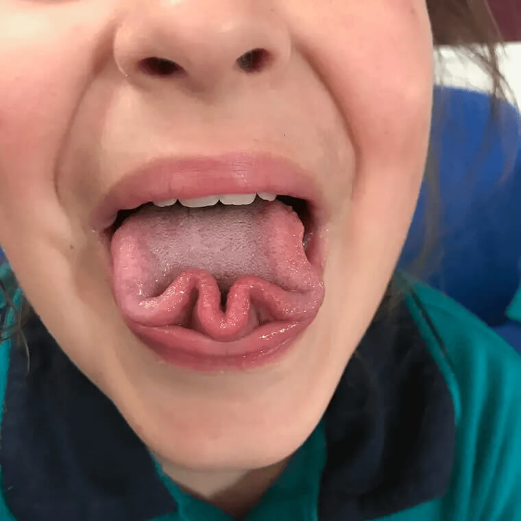 A Human’s Tongue Print Is As Unique As One’s Fingerprint