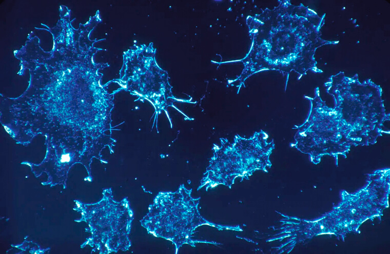There Is A Possibility That Your Body Has Fought Against Cancer Before
