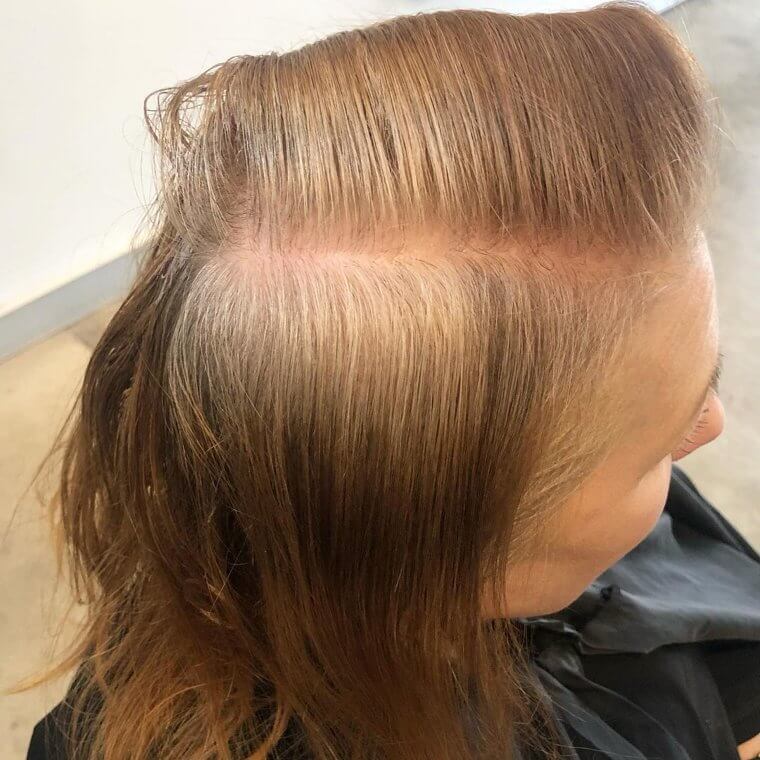 Rothaarige brauchen viel länger, um grau zu werden