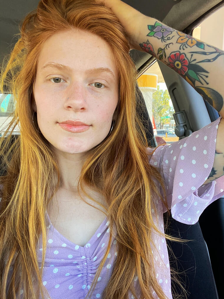 Rote Haare ermöglichen es manchen, ihr eigenes Vitamin D zu bilden