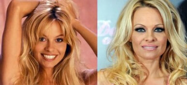 The Most Expensive Celebrity Plastic Surgeries Ever (And How Much They Cost)