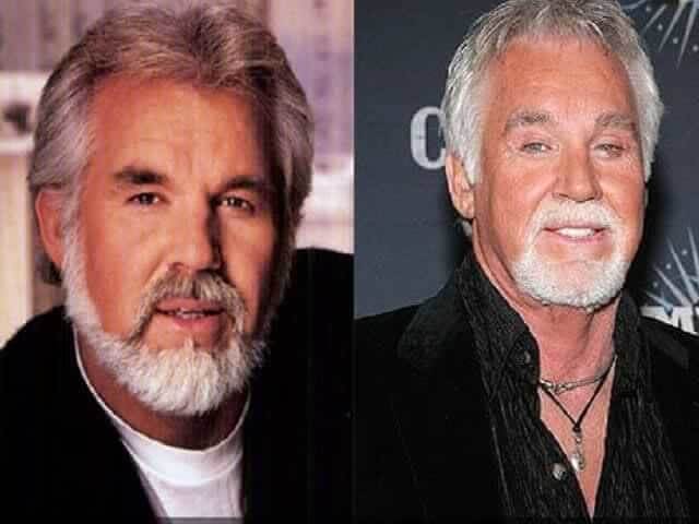 Kenny Rogers – Unknown