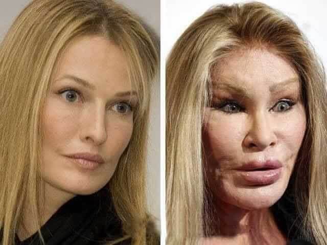 Jocelyn Wildenstein – $6.500,000