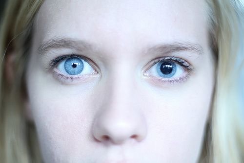 A Woman With Two Entirely Different Pupils