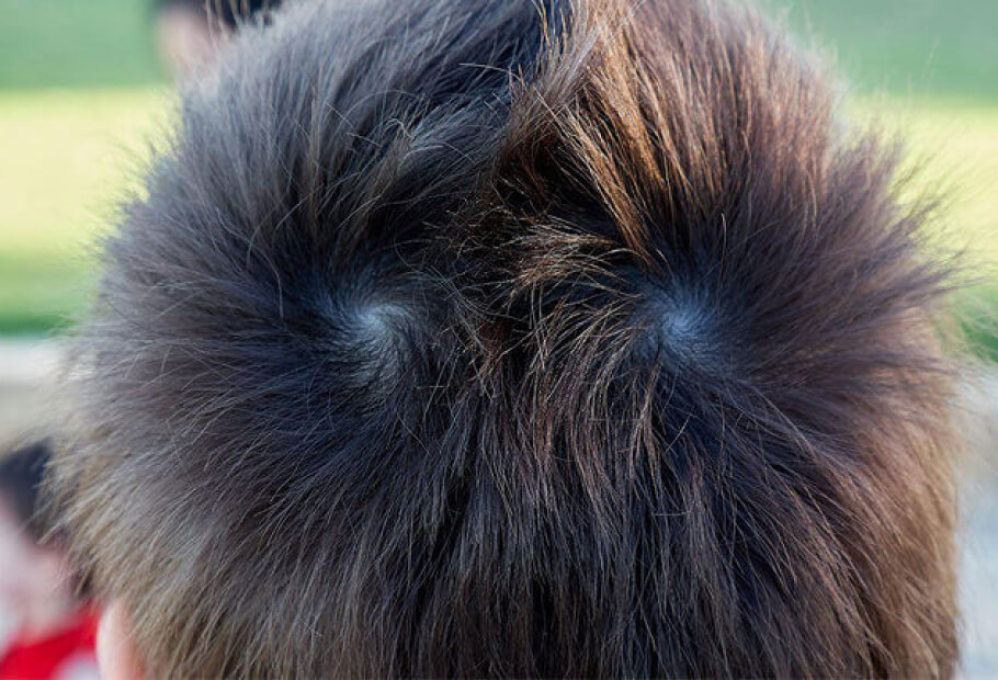 이 실제 사람들의 사진들은 유전학의 부인할 수 없는 힘을 보여줍니다