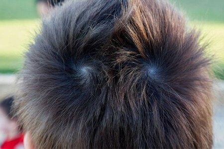 Ezek a valódi emberekről készült fotók a genetika tagadhatatlan erejét mutatják be