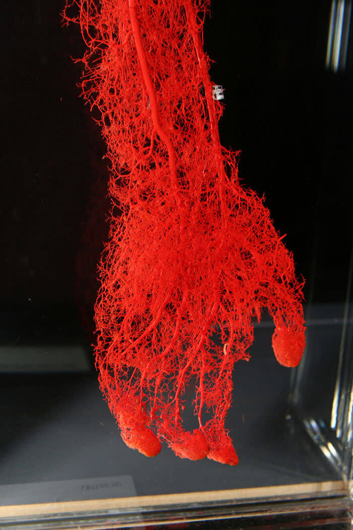 The Blood Vessels of A Hand