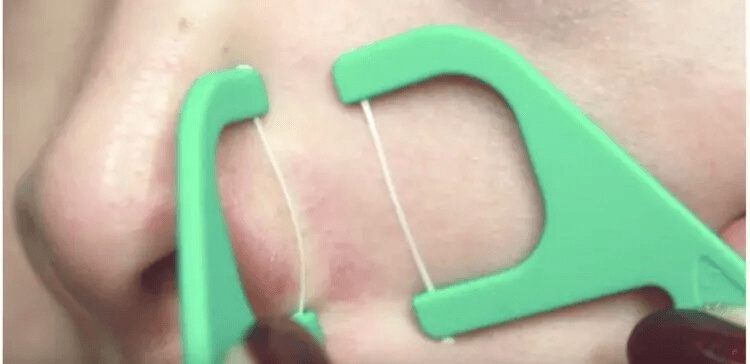 If Your Pores Are Annoying You, Use Dental Floss