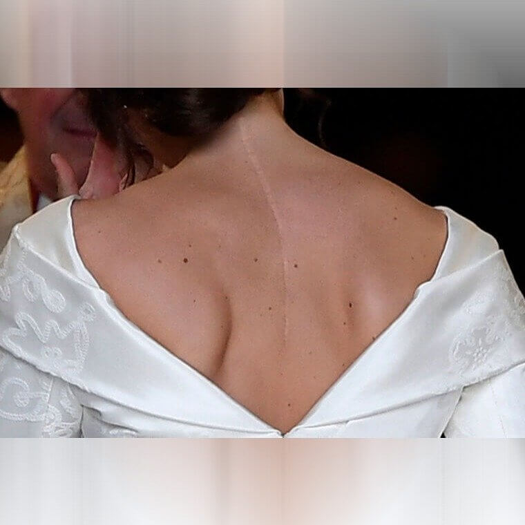 Sich unters Messer legen