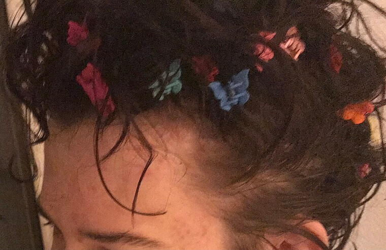 The 1990s "Butterfly Clips": Turning Every Head Into a Plastic Garden