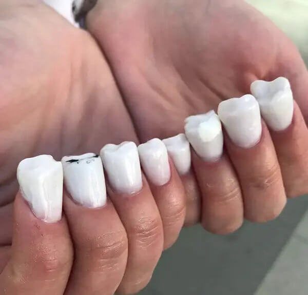 We Spot a Cavity