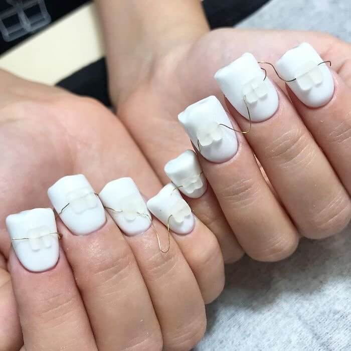 The World's First Finger Braces