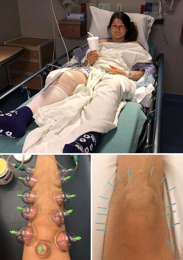 Skiing Caused This Athlete to Have a Pretty Intense Recovery