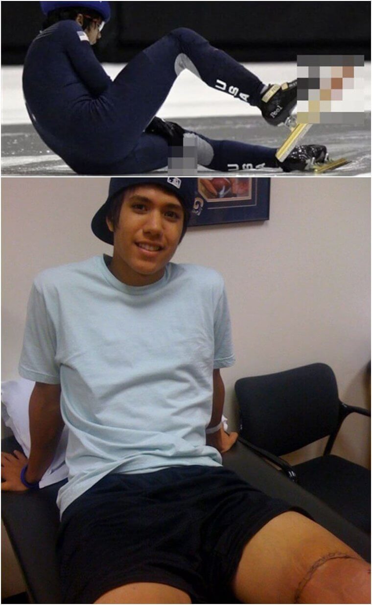 The Injuries Can Be Devastating, but That Doesn’t Stop Them