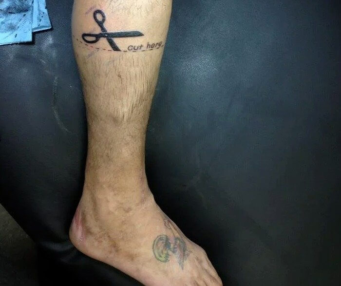 Body Integrity Identity Disorder Causes People To Want Amputations