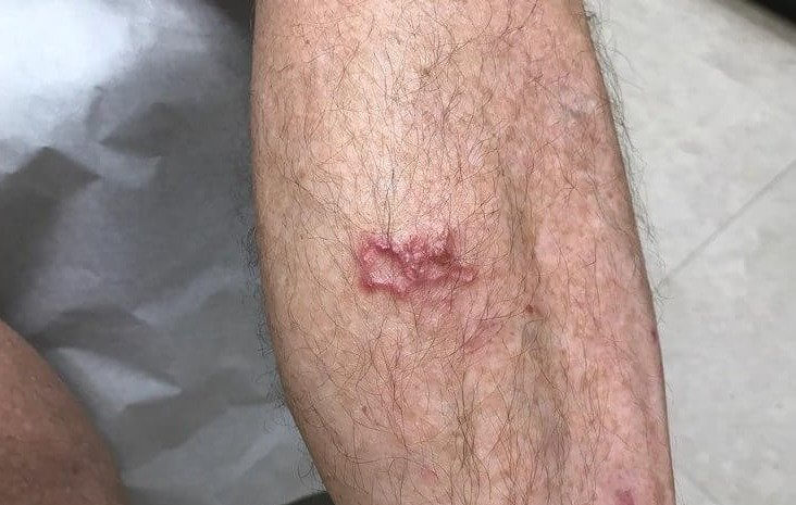 Most People Don't Know They Have a Parasite Until This Scary Thing Happens