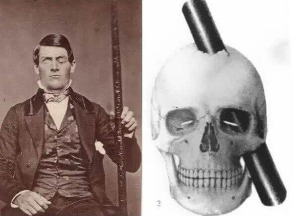 Can You Believe He Survived This?