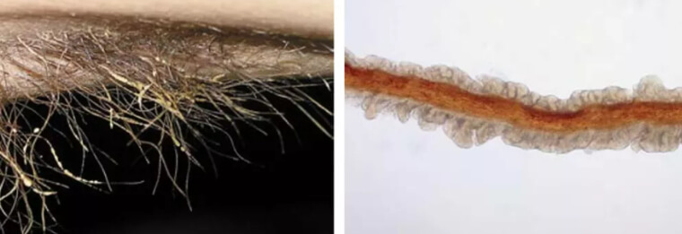 The Unexplainable Terrible Body Odor