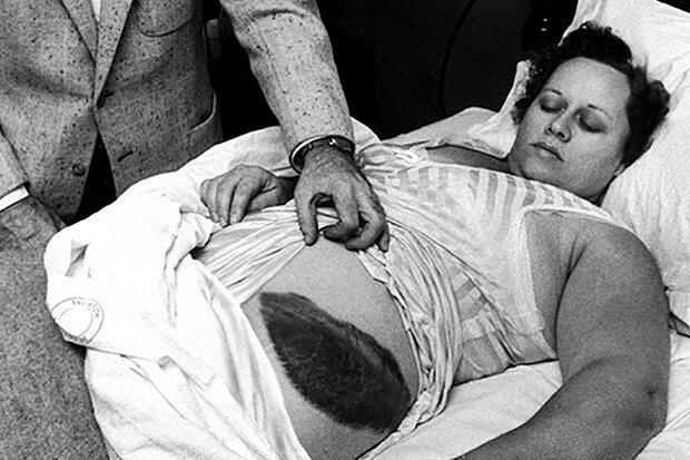 The Only Person to Be Hit by a Meteor