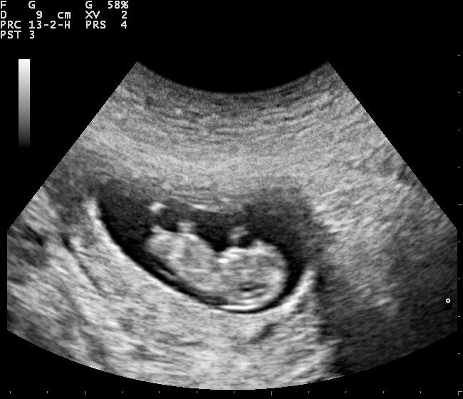 The Real Life Mother Mary (kind Of)