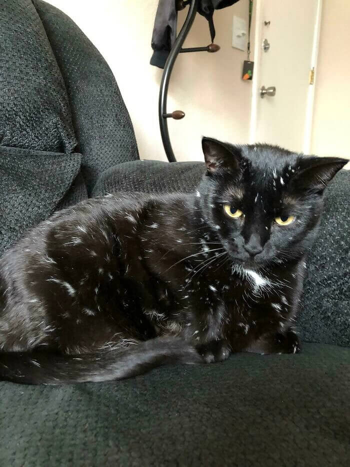 Beauty With Vitiligo