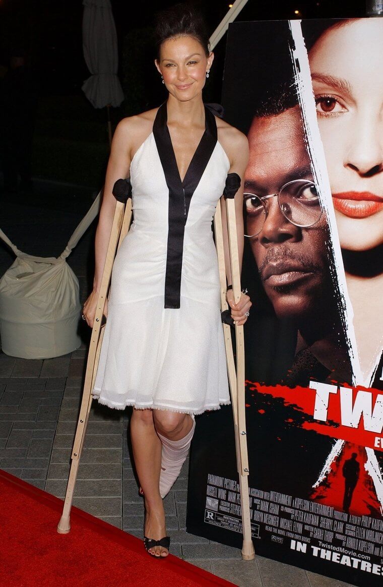 Her Congolese Companions Saved Her Leg
