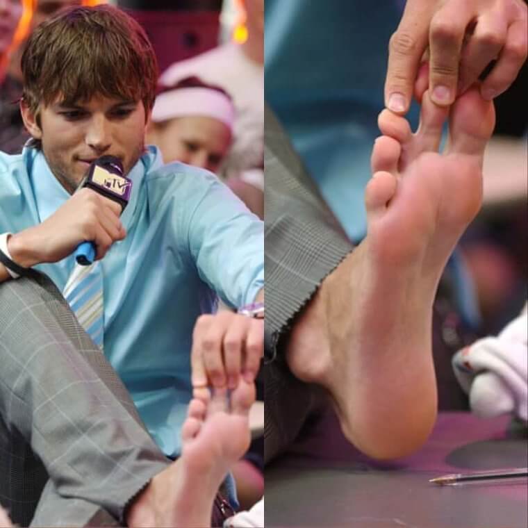 Ashton Kutcher Has Webbed Toes