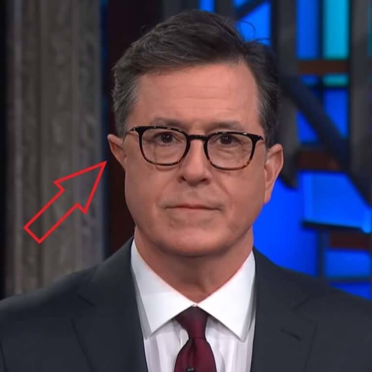 Stephen Colbert Has Lopsided Ears