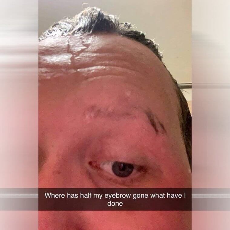 The Case Of The Missing Eyebrow