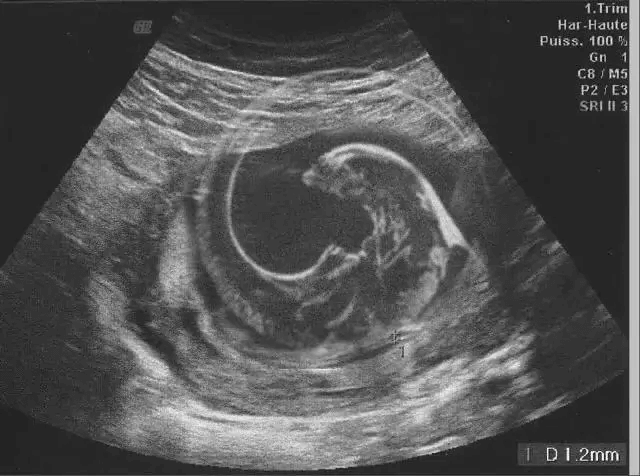 The Ultrasound Prank "Congrats! It's a... Dinosaur?!"