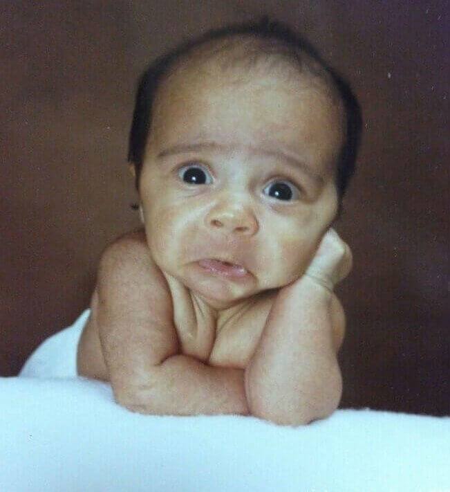 Medo No Rosto De Um Bebê