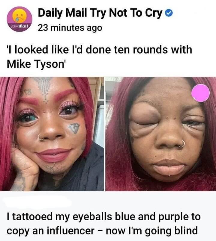 We Think Mike Tyson Won
