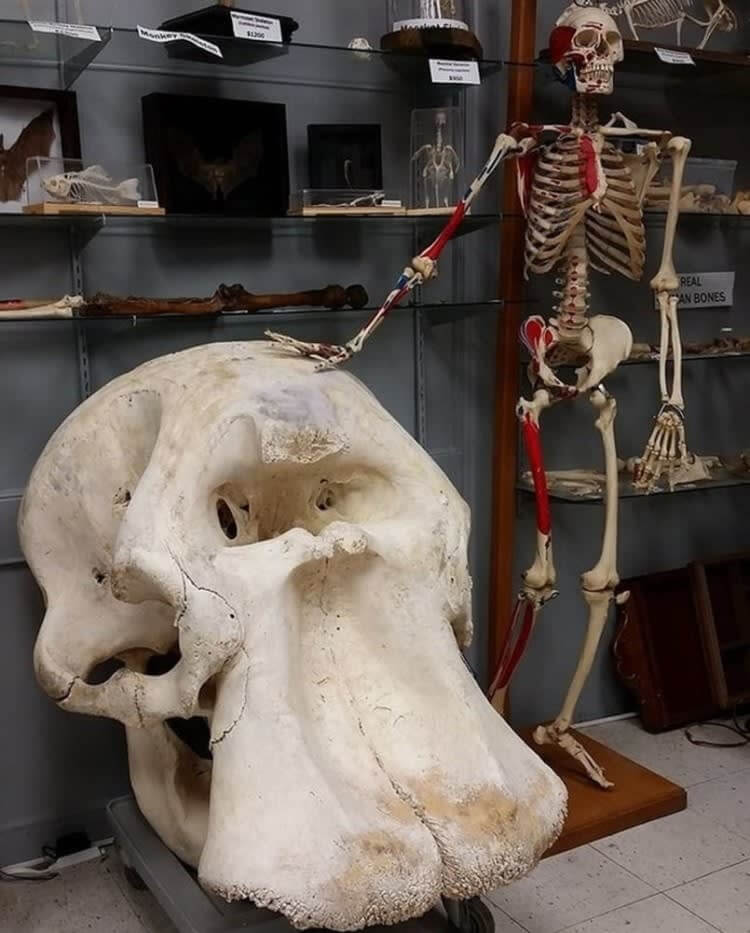 Esqueleto Humano Junto A Un Cráneo De Elefante Africano