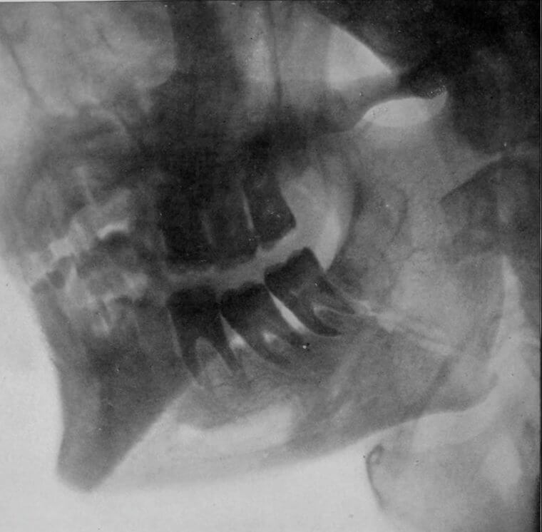 Teeth Don't Just Grow Inside Your Mouth