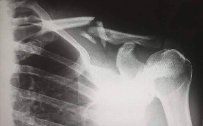The Dark History of Pediatric X-Rays